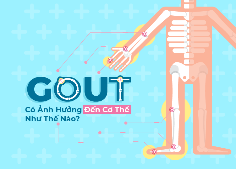BỆNH GOUT CÓ ẢNH HƯỞNG ĐẾN CƠ THỂ NHƯ THẾ NÀO? Bệnh Viện Quốc Tế Mỹ AIH