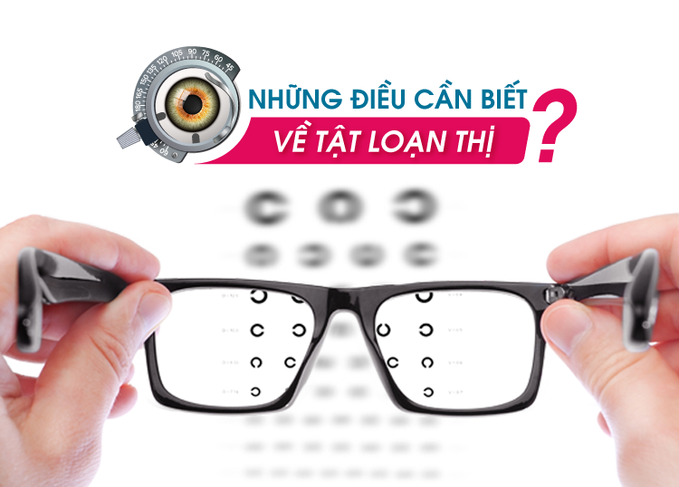 Những người có nguy cơ cao mắc phải loạn thị là ai? Làm thế nào để phòng ngừa loạn thị?
